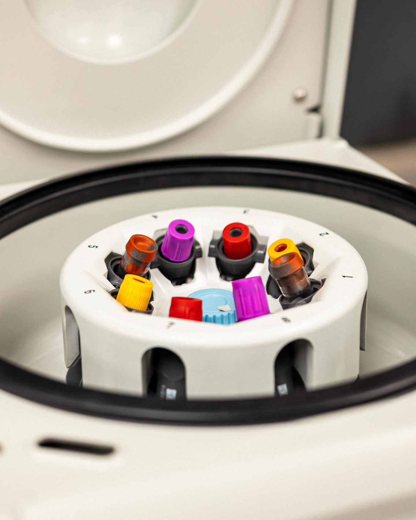 Centrifuge with blood samples in the SCRI laboratory